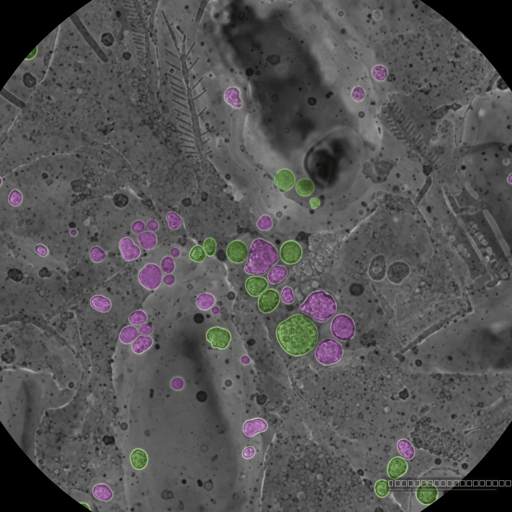 Nanogotas de silicato conjugadas: fósseis microscópicos de um resfriamento ultrarrápido, revelando a alquimia dos impactos na Lua.
